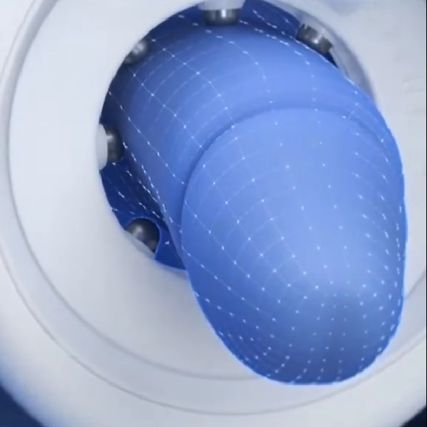 Precision Shock Wave Therapy Ring